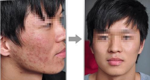 2024年南京整形醫(yī)院推薦：專業(yè)隆鼻哪家好？