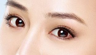 成都米蘭柏羽雙眼皮曝光！醫(yī)生做雙眼皮風(fēng)格如何？對(duì)比照片供參考