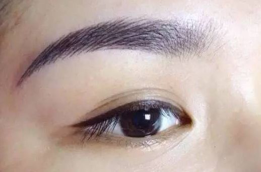 劉恒鑫與崔江波二選一，史上最真實雙眼皮整形案例揭示！點擊查看案例詳情！