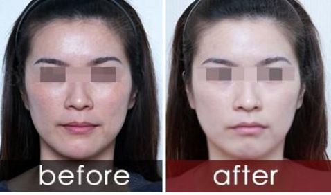 長沙亞太醫(yī)療美容，整形一家親