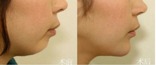 國內(nèi)知名的脫發(fā)治療機(jī)構(gòu)有哪些？這三家你必須了解