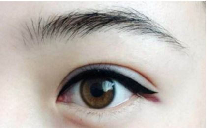 全國(guó)蜚聲修復(fù)雙眼皮大師排行榜