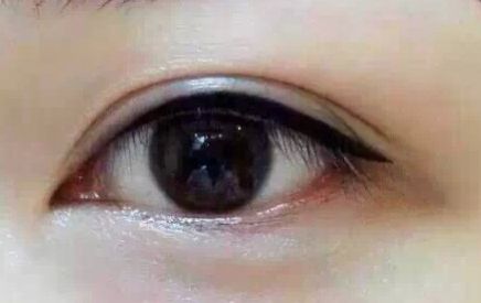 上海9院專(zhuān)家分享軟骨隆鼻案例，LiQingfeng的技術(shù)備受推崇！