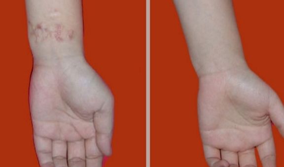 冬季補(bǔ)水逆轉(zhuǎn)肌膚暗沉，白皙水潤(rùn)大蛻變