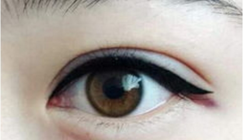 廣東做隆鼻哪家醫(yī)院的技術好？這五家公立醫(yī)院是值得一試的嗎？