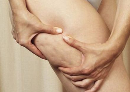 深圳哪家醫(yī)院拉皮手術(shù)效果好？專家推薦米蘭柏羽、美萊、藝星等醫(yī)院