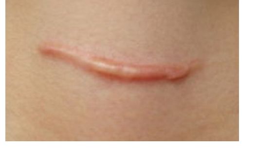 殷佳鵬整形醫(yī)生的技術與價格如何？