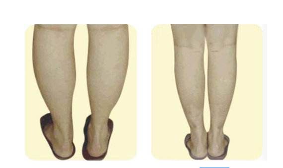 福州雷雪華醫(yī)生打造的鼻子效果如何？醫(yī)生實(shí)力及案例揭示