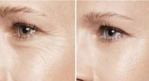 昆明雙眼皮手術(shù)哪家醫(yī)院靠譜？這三家值得了解