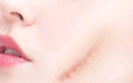 北京雙眼皮手術(shù)，牛人醫(yī)生排行揭秘