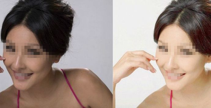 鄭州第二中醫(yī)院專家推薦：私密整形服務(wù)詳解，朱靜醫(yī)生實(shí)力解讀