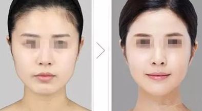 天津整形醫(yī)院綜合師資力量、設(shè)備設(shè)施等實(shí)力分析