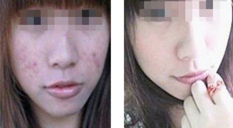 2024年蘇州市整形醫(yī)院鼻部修復手術(shù)前十強大揭秘