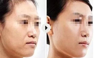 合肥青少年錯合畸形治療專家吳建華推薦