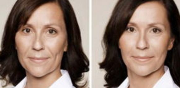 西安哪家醫(yī)院做隆鼻好？整形鼻部醫(yī)院匯總6家