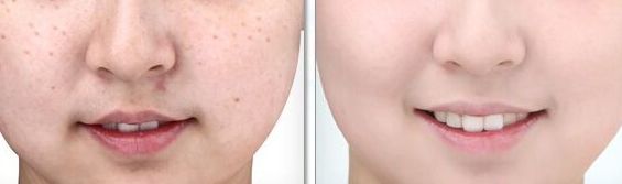 醫(yī)生工作室的預(yù)約方式介紹！蘇薇潔醫(yī)生眼整形工作室的成功案例展示！