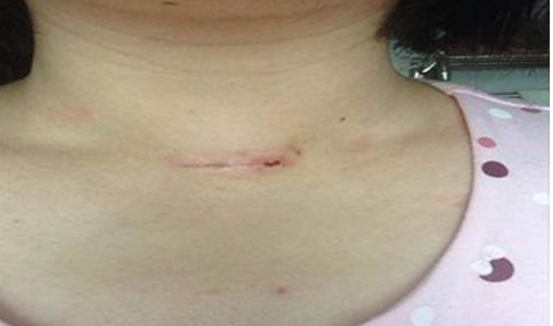 錦州附屬二院口腔修復(fù)科優(yōu)秀專家團(tuán)隊及種植牙成功案例匯總