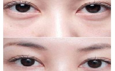 云南雙眼皮醫(yī)生排行榜2023：揭秘5位頂尖專家，讓您輕松煥發(fā)雙目魅力！