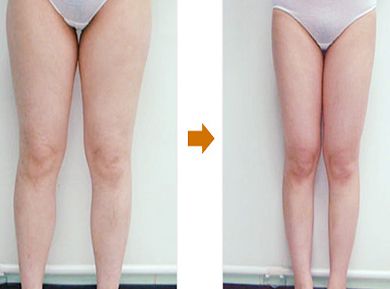 上海柴軍醫(yī)生的鼻子整形案例亮相，效果如何？