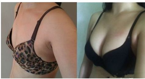 重慶華美眼科醫(yī)生排行榜！五位專家引領(lǐng)潮流，獨家案例與預(yù)算揭秘！