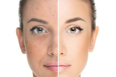 植發(fā)報(bào)銷醫(yī)保指南及價(jià)格解析