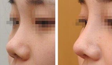 上海第九人民醫(yī)院乳房重塑的頂尖醫(yī)生有誰(shuí)？專家推薦+服務(wù)收費(fèi)參考