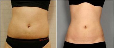 蘇州美容整形醫(yī)院綜合實(shí)力巔峰，排名前三不能錯(cuò)過(guò)