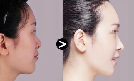 昆明專業(yè)整形治療醫(yī)院揭秘！口碑TOP10震撼推薦，守護(hù)您的隱私需求！