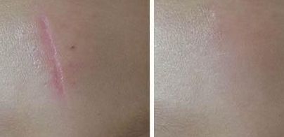 尋覓醫(yī)術(shù)出眾的武漢雙眼皮修復(fù)醫(yī)生，誰是不二之選？