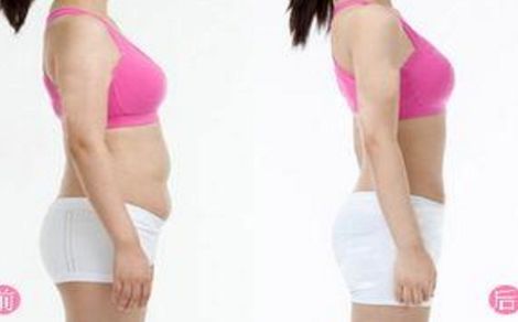 上海哪家做脂肪填充醫(yī)院好？杰出醫(yī)生張懷軍和桑建波如何評(píng)價(jià)？