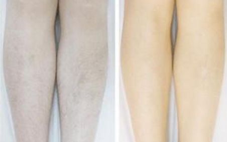 邯鄲市綜合整形醫(yī)院呈現(xiàn)！格調(diào)超群的實(shí)力派醫(yī)療中心震撼揭曉！