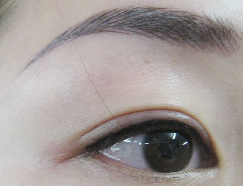 上海九院金云波醫(yī)生口碑大揭秘！驚艷新款雙眼皮修復(fù)案例曝光