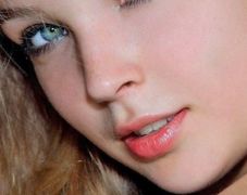 郭波雙眼皮手術(shù)效果如何？90天后恢復情況揭示