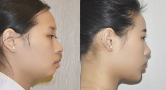 開拓視野：為什么有人眼角比較好看？