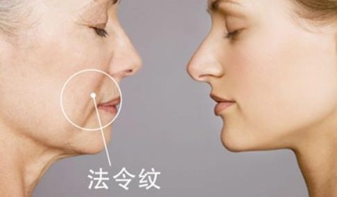 武漢雙眼皮醫(yī)生哪些技術強？陳宏案例揭秘前五強！