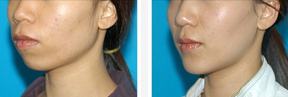 吉林梁惟苓整形醫(yī)院專(zhuān)業(yè)項(xiàng)目與技術(shù)介紹