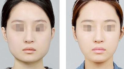 周海峰醫(yī)生受邀無錫坤如瑪麗醫(yī)院擔(dān)任醫(yī)療顧問，技術(shù)專業(yè)可信賴