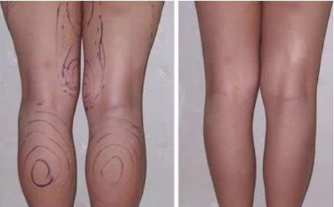 廣東省整形醫(yī)院新聲，權(quán)威排名榜單曝光