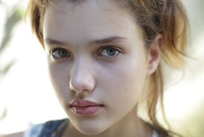 蘇州市立醫(yī)院雙眼皮割好不好？