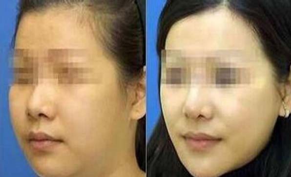 南京市優(yōu)質整形醫(yī)院排行榜最新發(fā)布