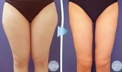 杭州痤瘡修復?？漆t(yī)院推薦