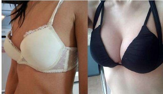 長沙雙眼皮手術：田芳斌與解燦哪位醫(yī)生更優(yōu)秀？前五專家詳細介紹！有必要留存~