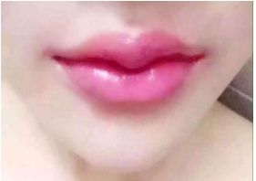 沈陽(yáng)改善鼻形效果的專(zhuān)業(yè)醫(yī)院有哪些？全新排名最新發(fā)布，值得收藏參考