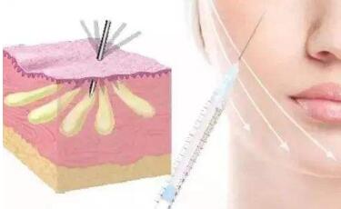 武漢仁愛時光吸脂手術(shù)優(yōu)質(zhì)可靠嗎？它有哪些優(yōu)點？