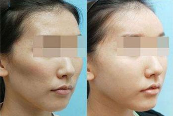 杭城翹楚！這些整形醫(yī)院實力超群，咱們先來看看有哪些？