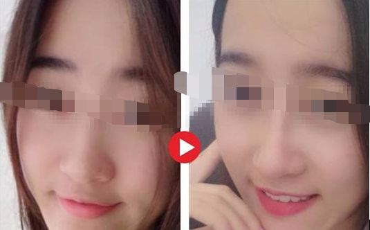 【2024年】蘇州哪家整形醫(yī)院口碑最好？評(píng)選出的前三強(qiáng)！