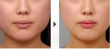 復(fù)旦大學(xué)附屬眼耳鼻喉科醫(yī)院：綜合淺談上海五官科醫(yī)療中心魅力