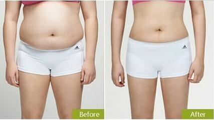 廣州雙眼皮整形醫(yī)院排名前十榜單已定！難道紫馨和軍美是口碑比較好的選擇？