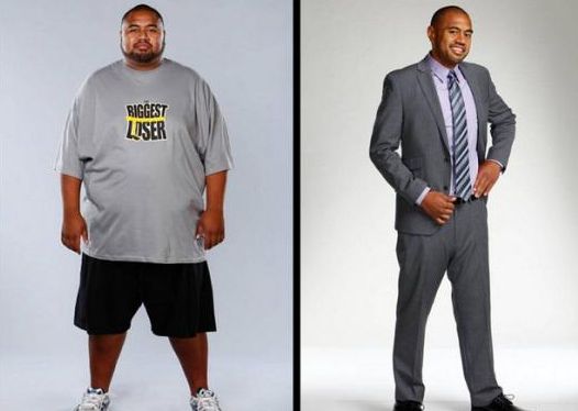 上海九院激光脫毛價格資訊，推薦專家選擇