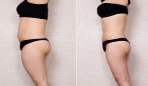 蘇州整容美容科醫(yī)院排行榜top6：鼻部整容實(shí)力醫(yī)院大揭秘！